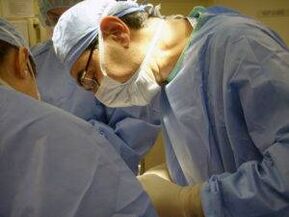Surgery to increase a member
