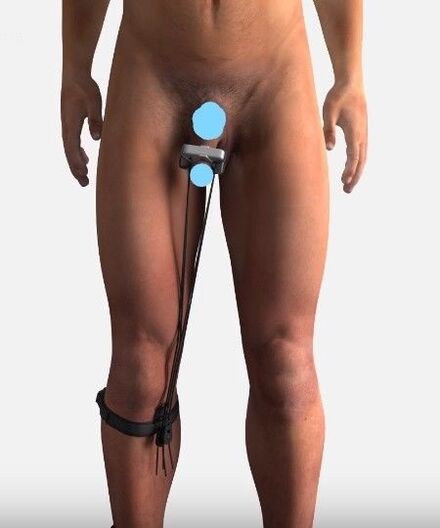 A device to increase a member